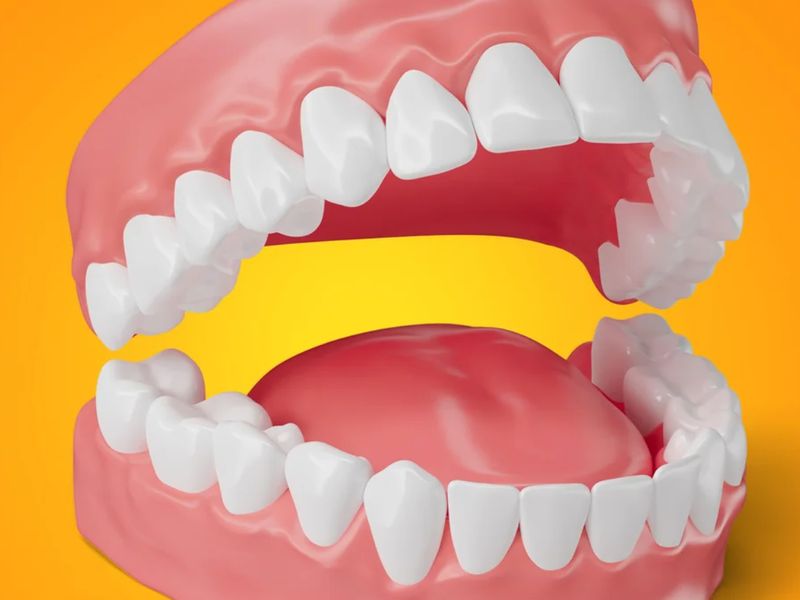 Model of a full set of upper and lower teeth