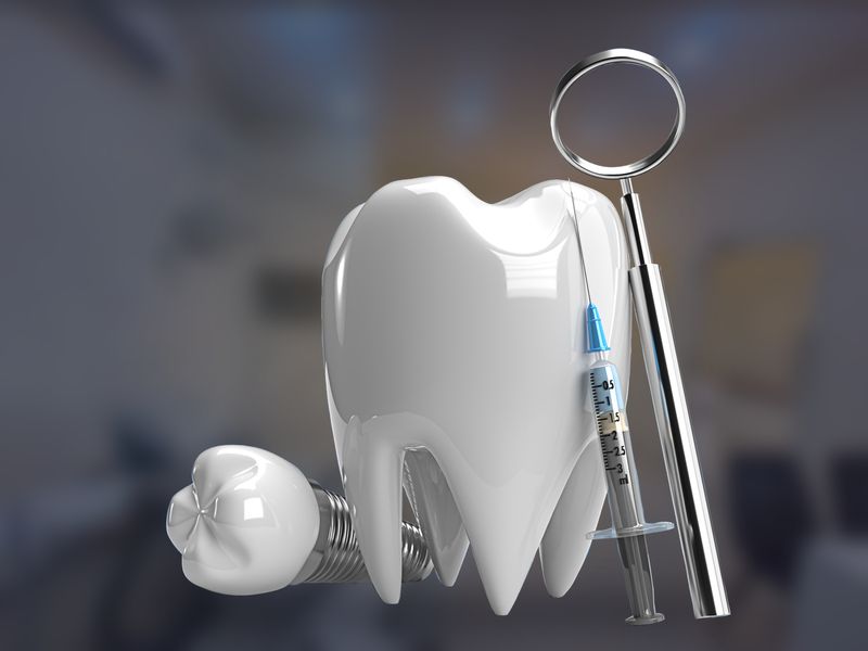 Model of a tooth with a dental implant, dental mirror and syringe